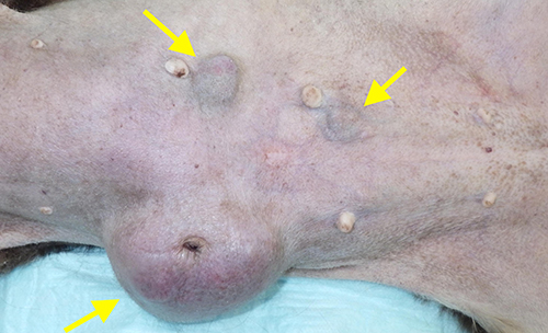 乳腺腫瘍