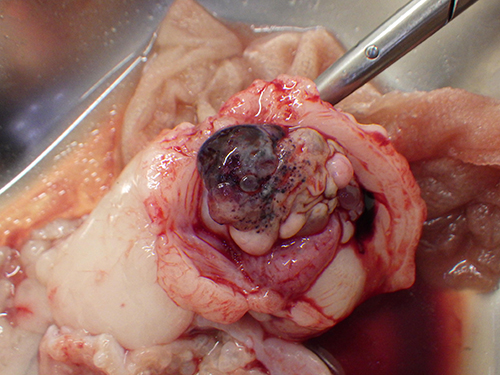 卵巣腫瘍